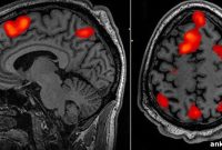 Are Mind-Reading Brain Scanners Leading to Big Brother?