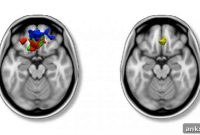 New Dimensional Method Reveals Biomarker for Inattention