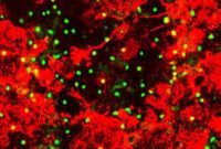Brain Repair Breakthrough Brings Hope for Multiple Sclerosis