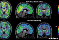 How Sleep Deprivation Affects the Brain