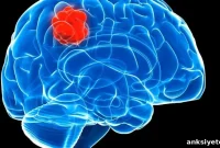 Scientists Identify Enzyme That Fuels Brain Tumor Growth