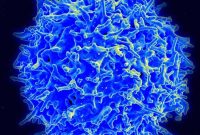 Autoimmune Links Found in Parkinson’s Disease