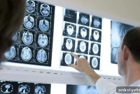 Alzheimer’s vs Dementia: Key Differences, Symptoms and Causes