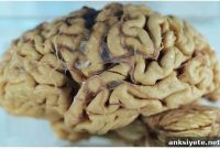 Study Finds Bacteria in Alzheimer’s Brains