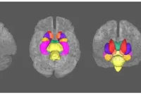 How Depression Changes Brain Structure