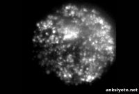 Protein Breakthrough Sheds Light on Parkinson’s Disease