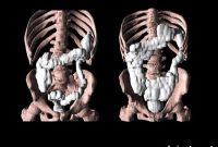 Gastrointestinal Symptoms in Parkinson’s Patients: New Insights