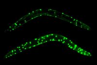 It’s Not Just What You Eat: How Gut Microbes Affect You