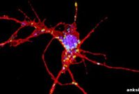 Study Finds Friend of Fragile X Gene Influences Learning