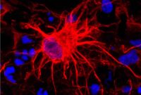 Researchers Give Astrocytes VIP Treatment to Boost Brain Repair