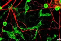 Acid-Sensing Receptor Linked to Panic Disorder Symptoms