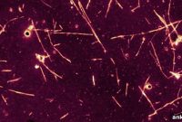 Molecular Breakthrough Links Parkinson’s and Prion Diseases