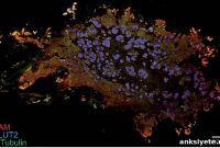 Scientists Identify Cause of Smell Loss in Parkinson’s