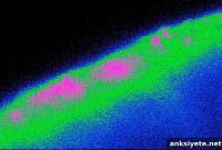 Scientists Identify Brain Cells That Control Appetite