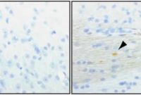 Parkinson’s Gene Required for Dopamine Neuron Survival
