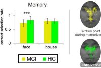 Early Dementia Impairs Face Recognition and Memory
