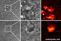 New Imaging Reveals Alzheimer’s Progression Inside Cells