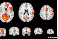 Neurofeedback May Reduce Tinnitus Symptoms