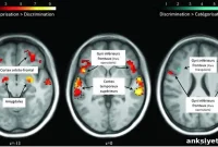 What Your Forehead Reveals About Emotions and Voice