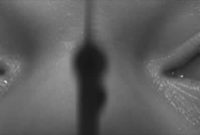 Rapid Neurological Assessment: Spot Problems in Seconds