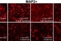 New Study Reveals Potential Therapy for Parkinson’s