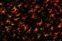 When Glial Cells Turn Against Your Brain: Causes and Effects