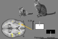 Brain Scans Reveal Neurological Clues Behind Pedophilia