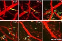 Compound Prevents Activation of Breast Cancer Brain Metastases