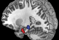 Declining Dopamine Neuron Activity Signals Early Alzheimer’s