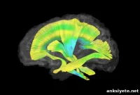 Brain Imaging Reveals Early Differences in Infants with Fragile X