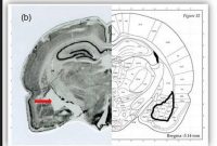 New Study Pinpoints Amygdala Region Tied to Taste Aversion