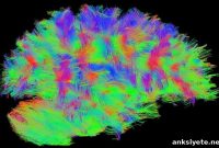 Tic-Tac-Toe MRI Pattern Boosts Neurological Disease Research