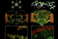 Alzheimer’s Plaque Impacts Brain Cell Types Differently