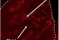 How Striosome Neurons in the Basal Ganglia Drive Learning