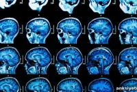 Brains of Teens with Severe Behavioral Disorders Wired Differently