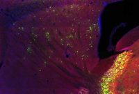 Where Brain Cells Get Input Could Shape Their Role in Disease