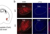 The Brain Circuit That Triggers Anxiety