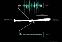 How Enteric Nervous System Neurons Keep the Colon Moving
