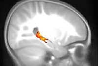 fMRI Shows Toddlers Form Memories During Sleep
