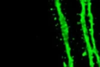 Newborn Neurons: The Challenging Path to Survival