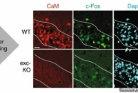 Faulty Neural Transport Impairs Learning in Brain Disorders
