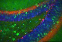 Ion Channel Marks Newborn vs Mature Neurons in Adult Brain