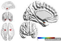 Brain Scans Distinguish Bipolar Disorder from Depression
