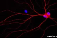 UCSB Researchers Identify New Pathway in Alzheimer’s Disease