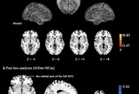 Men’s Online Gaming Addiction Impairs Brain Impulse Control