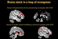 New Study Identifies Brain Mechanisms Behind OCD
