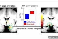 How Obesity Affects Sleep Quality and Daytime Energy