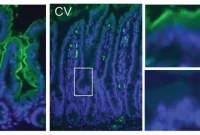 How the Gut Microbiome Regulates Intestinal Immunity