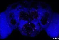 When Losing Neurons Can Benefit the Brain