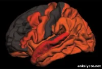 Less Deep Sleep May Signal Early Alzheimer’s Risk
